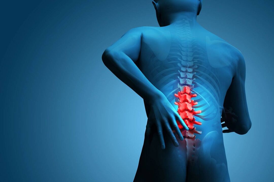 pijn met lumbale osteochondrose